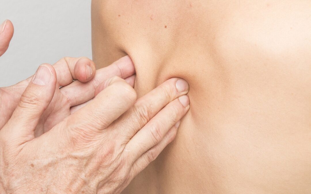 Acupuncturists love the term “Stagnation” to describe pain!