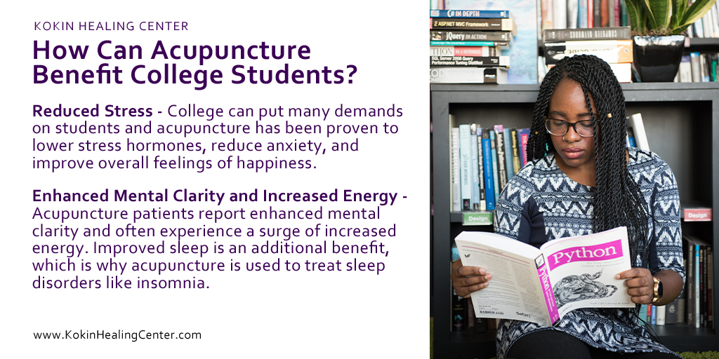 Acupuncture Treatment For Stressed College Students