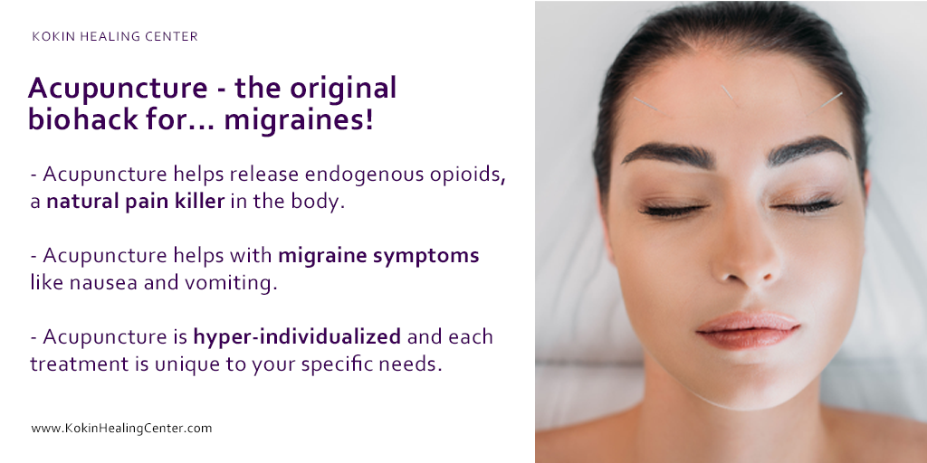 Acupuncture- the original biohack for… migraines!