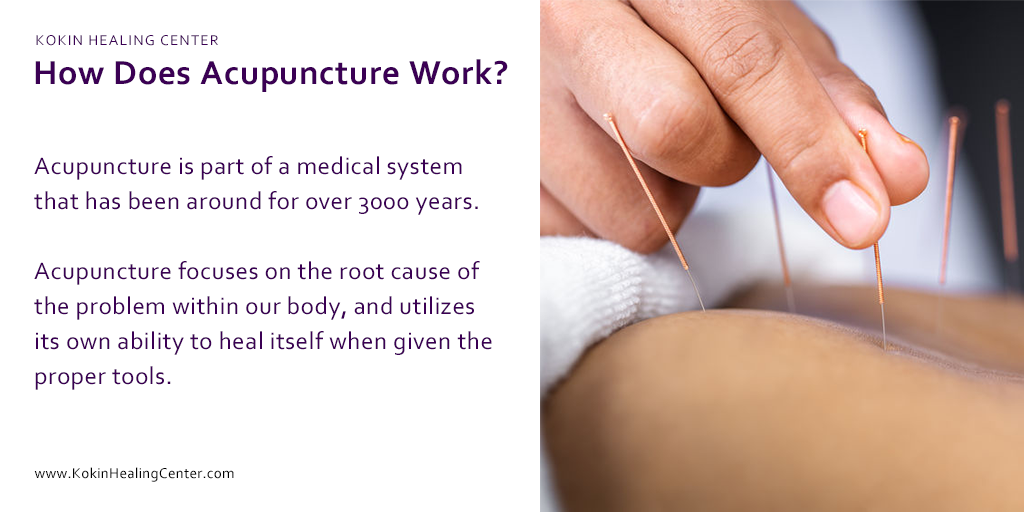How Does Acupuncture Work?