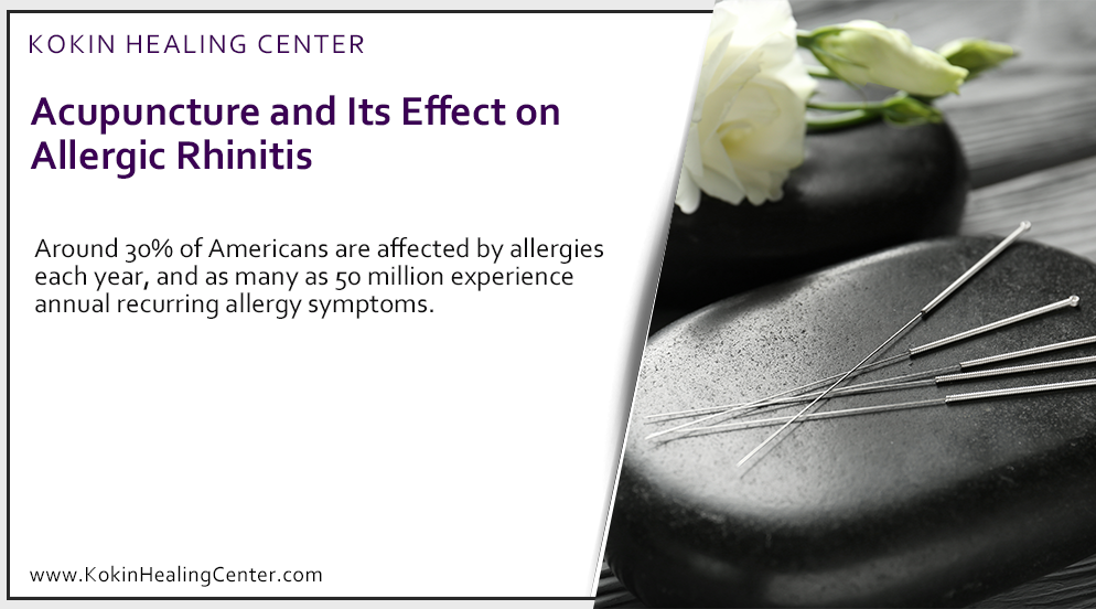 Acupuncture, and Its Effect on Allergic Rhinitis