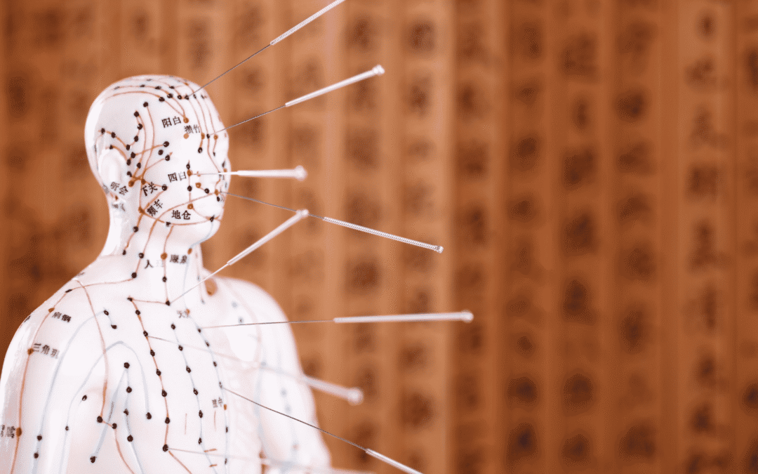 Managing Arthritis Naturally