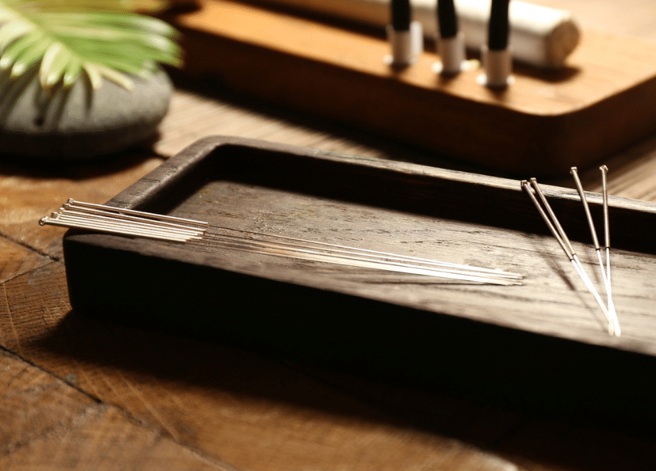 Can Acupuncture Help With Diabetes?