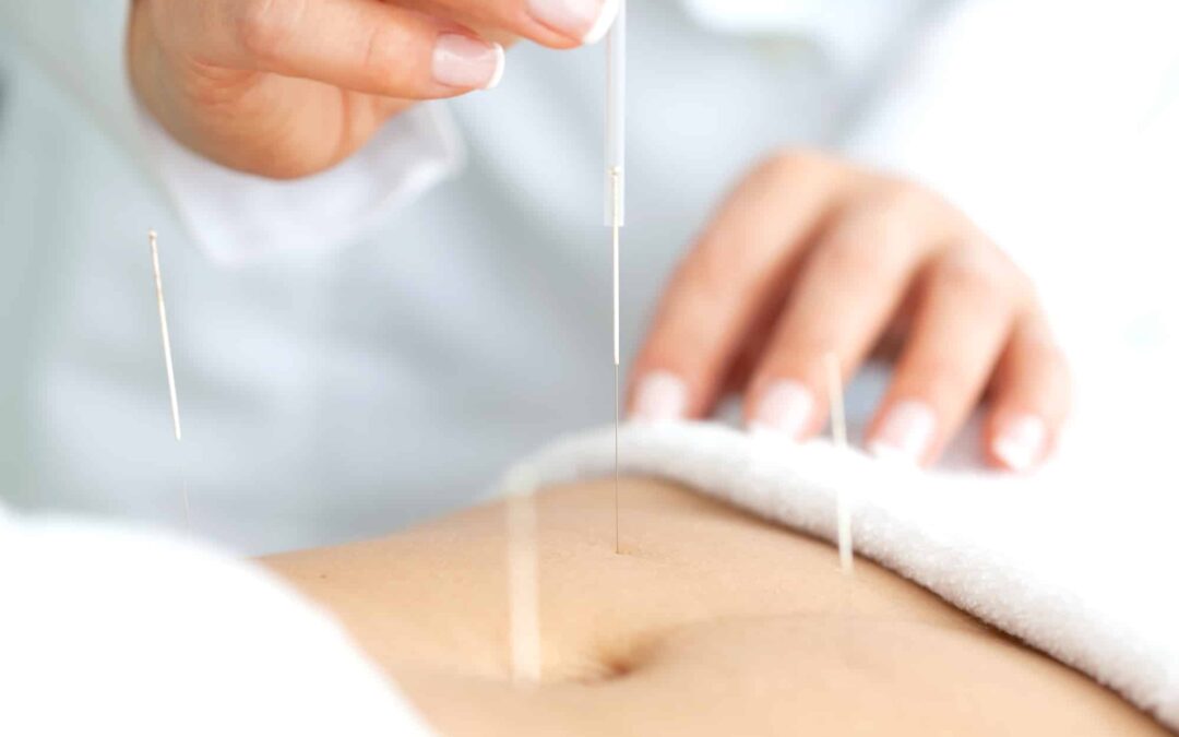 Acupuncture and Fibroids – Which Fibroids are you?