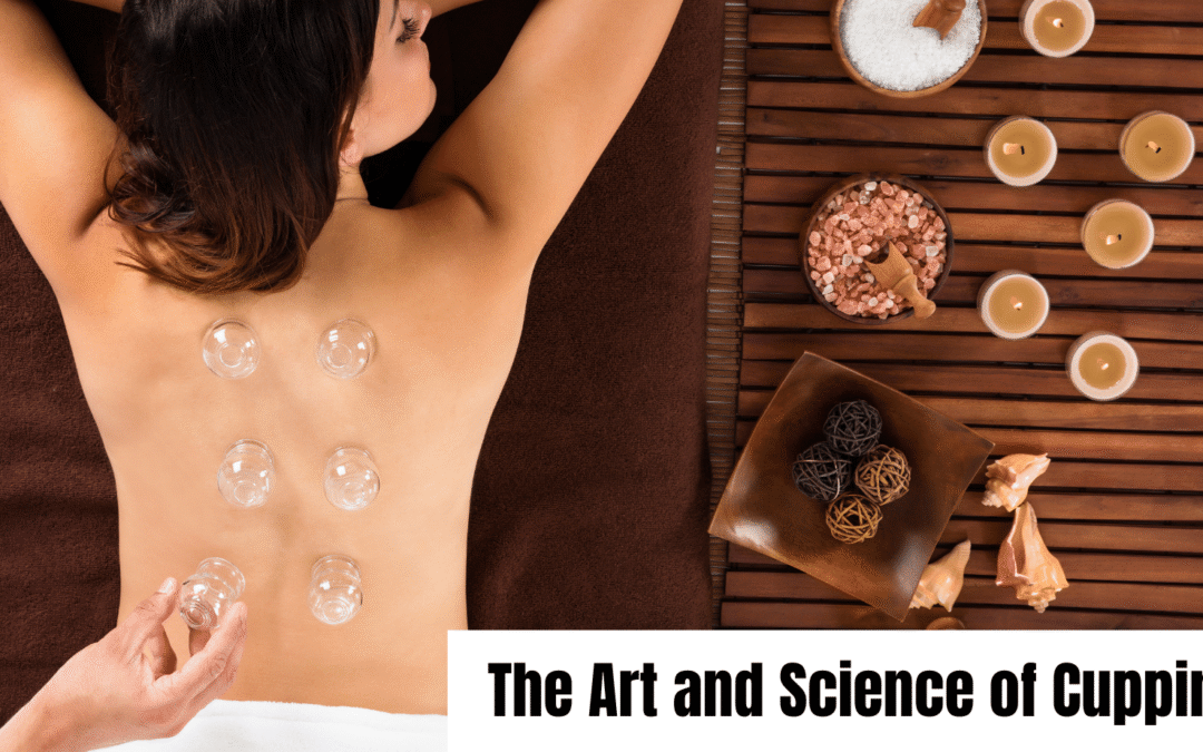 The Art and Science of Cupping