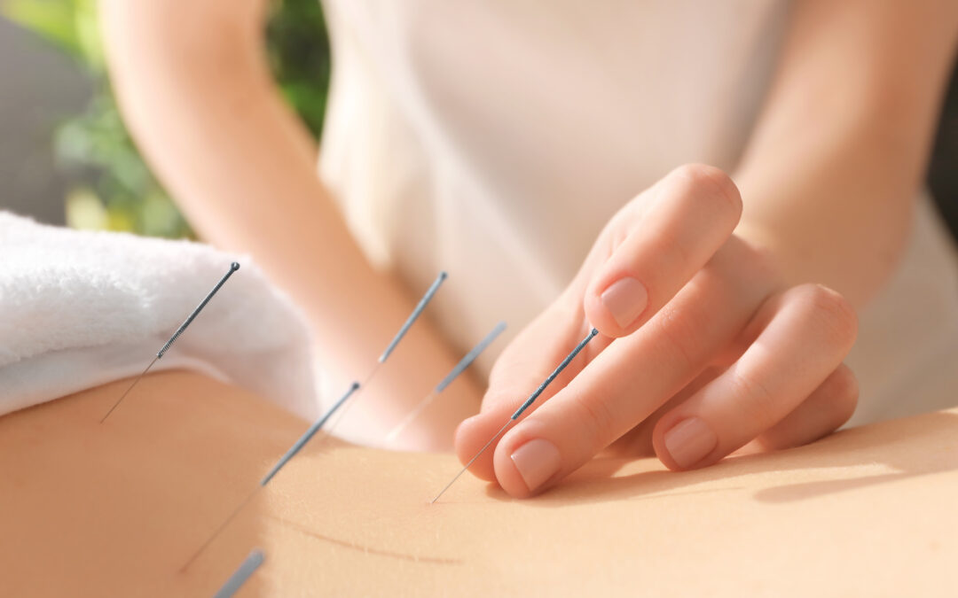 Start the New Year Off Right: Get Acupuncture