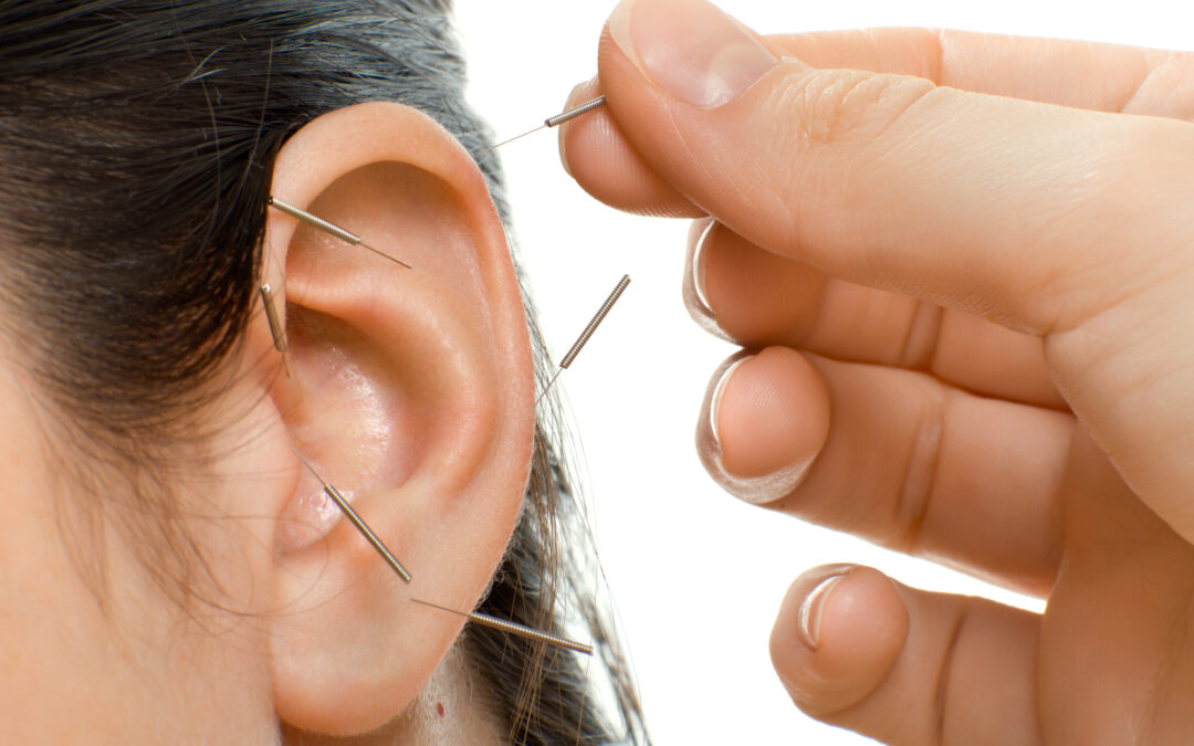   Ear Acupuncture for Sore Throat